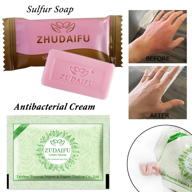 Sulfur Soap  Zudaifu