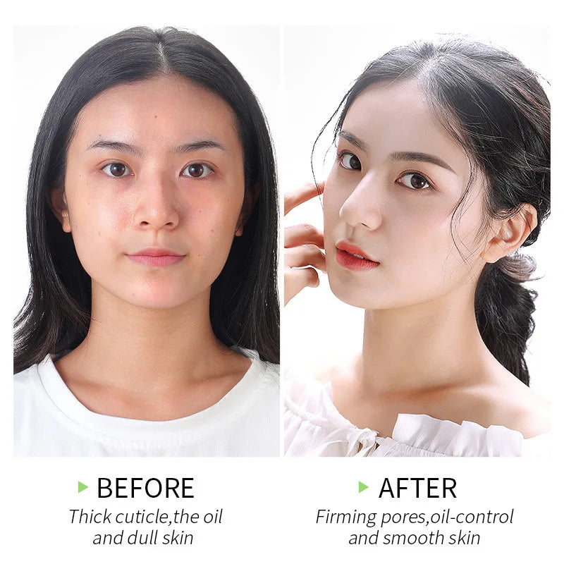 LAIKOU moisturizing facial exofiating gel