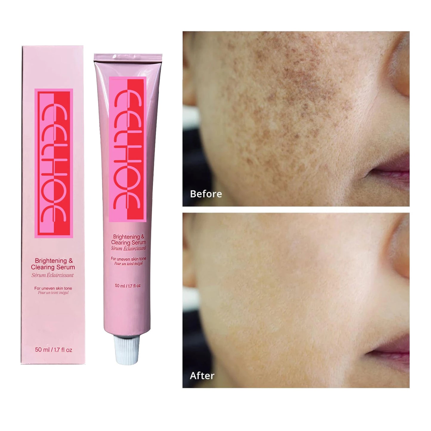 Effective Whitening Freckle Cream Fade Dark Spot
