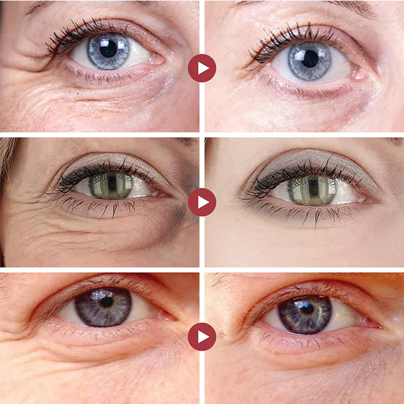 Anti-Wrinkle Eye Cream Retinol Remove Eye Bags
