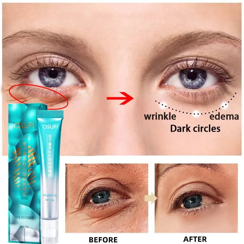 Anti-wrinkle and anti-bag eye cream 7 days
