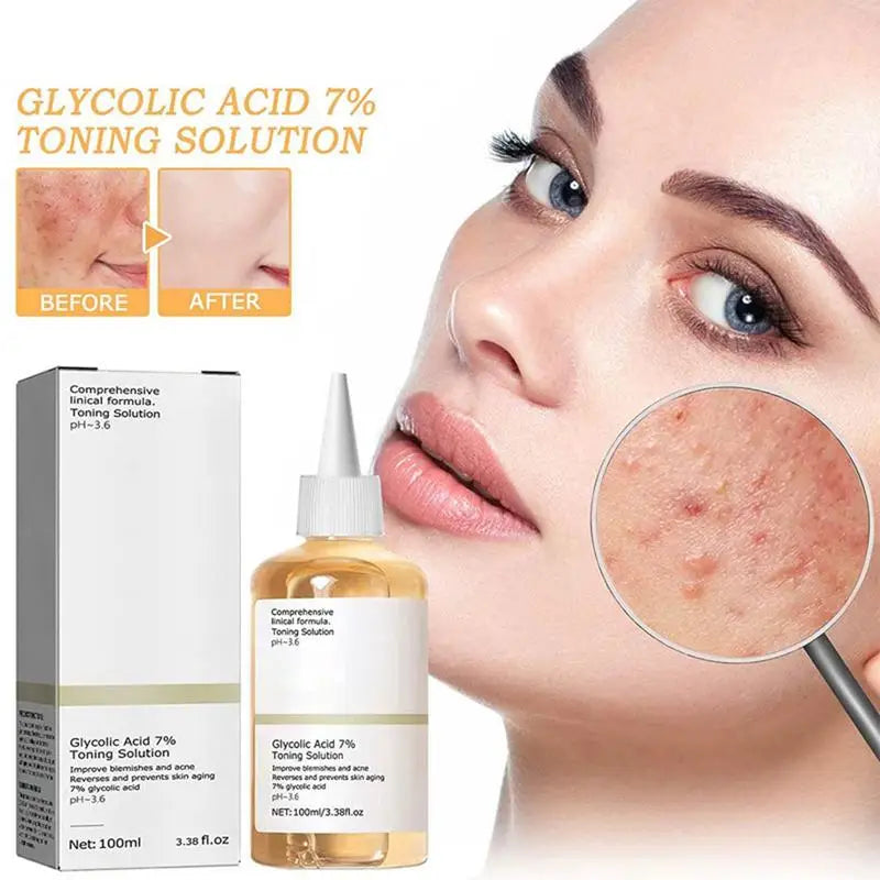 Glycolic Acid 7% Toner Remove Acne Fade Acne Marks Moisturize