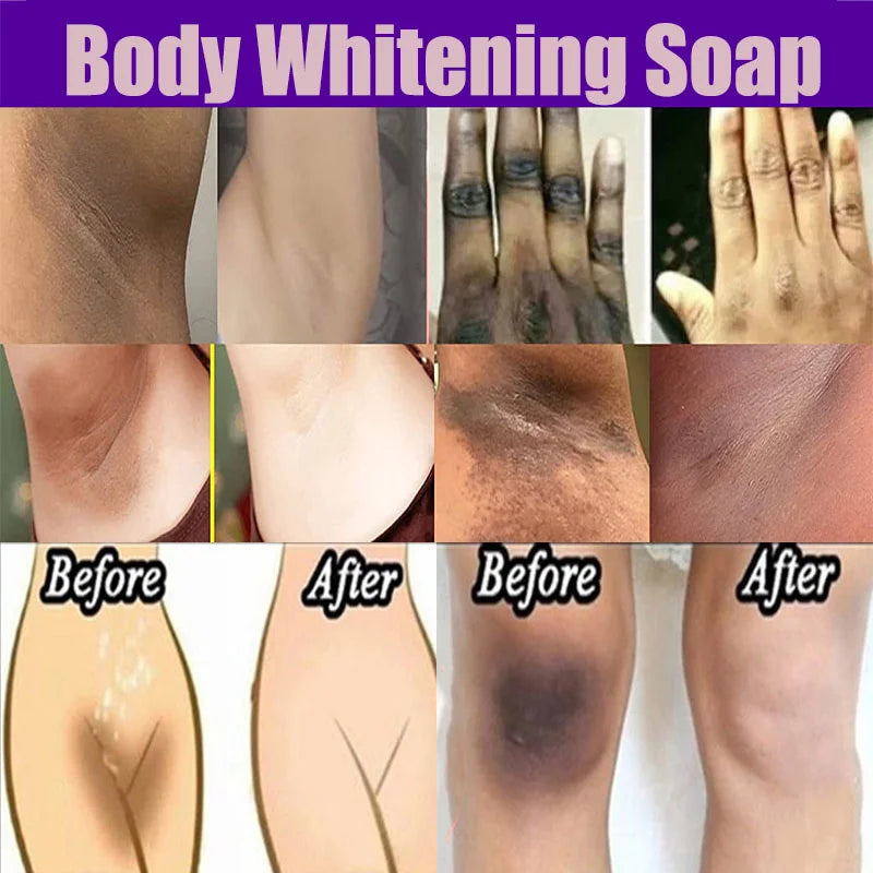 Body Whitening Soap