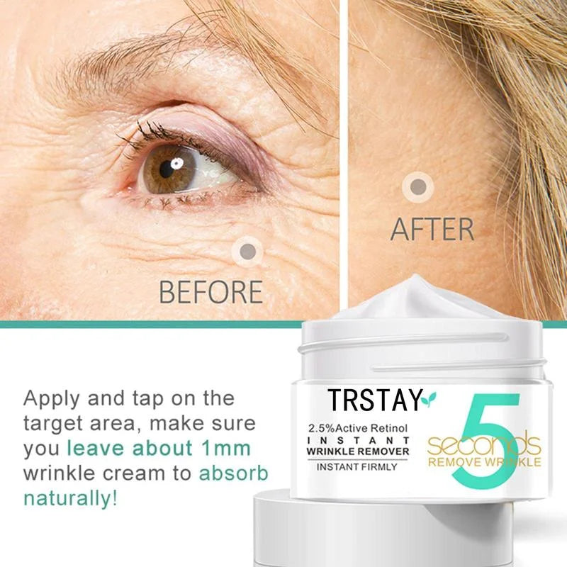 Anti-wrinkle and anti-bag eye cream with retinol