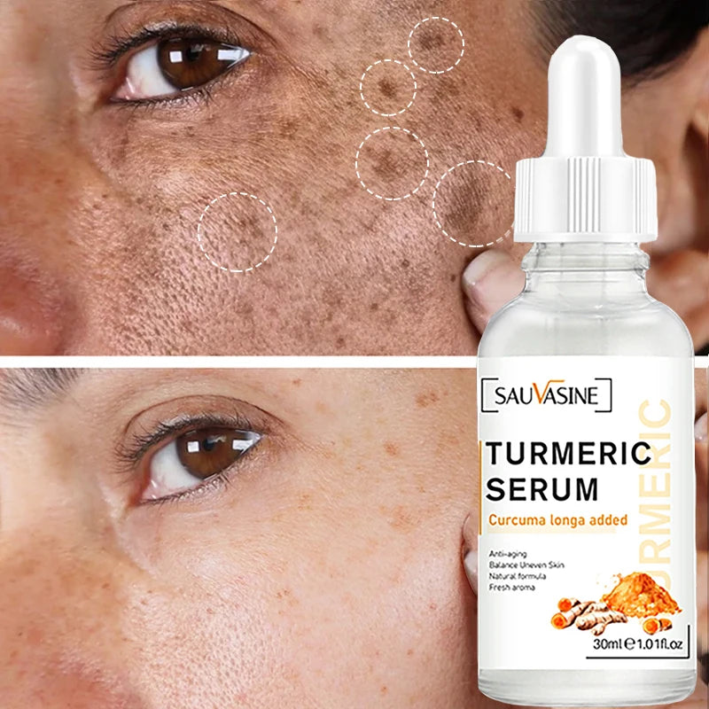 Turmeric Whitening Freckles Serum Cream Remove Dark Spots