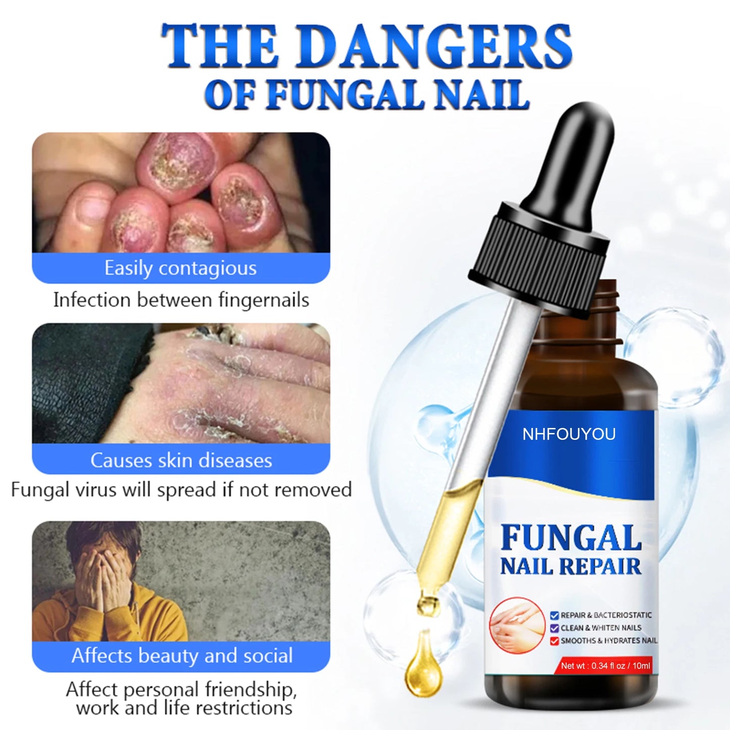 Anti Infection Nail Fungus Treatment Oil
