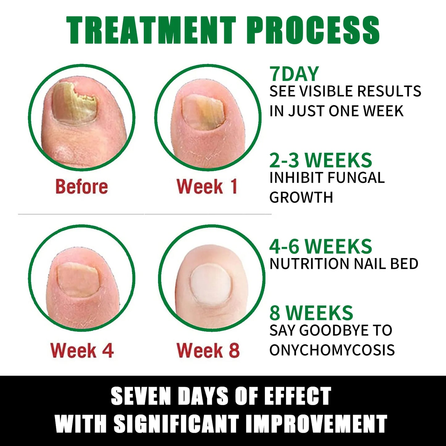 Treatment to eliminate nail fungus, 7-day repair