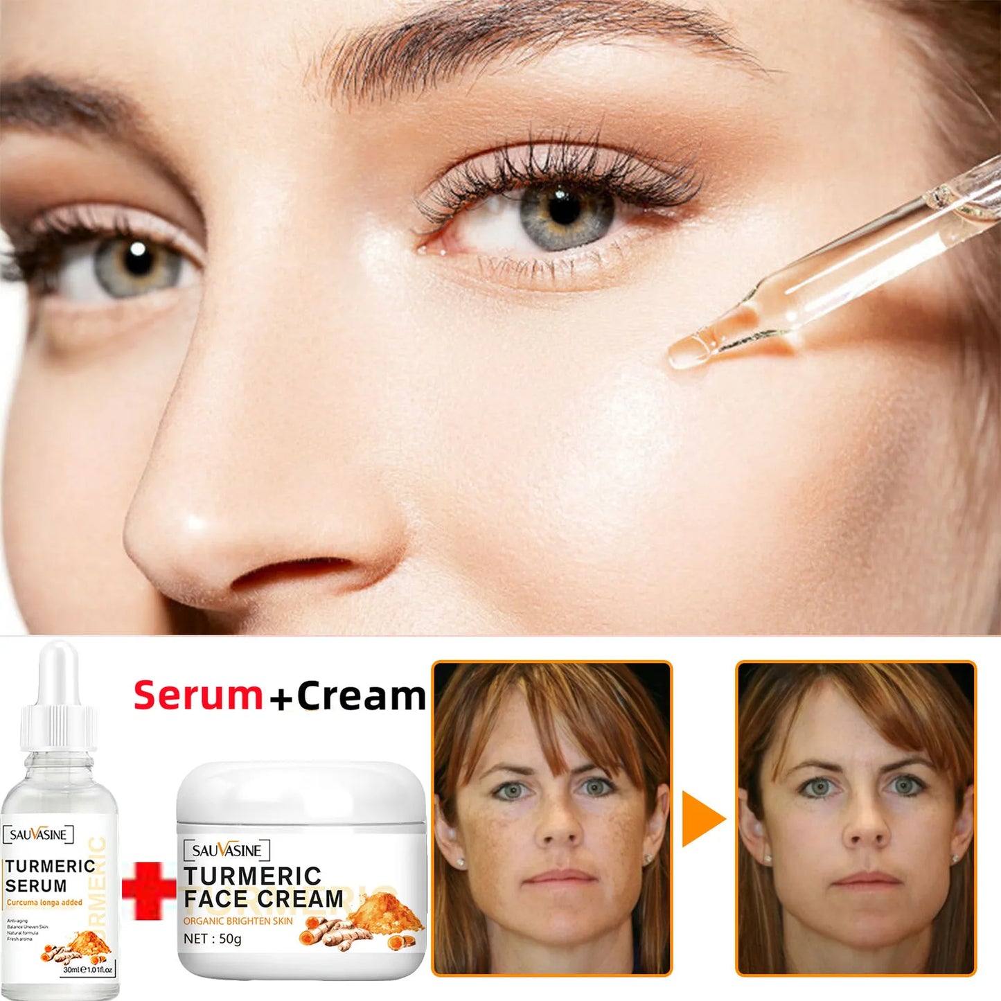 Turmeric Whitening Freckles Serum Cream Remove Dark Spots