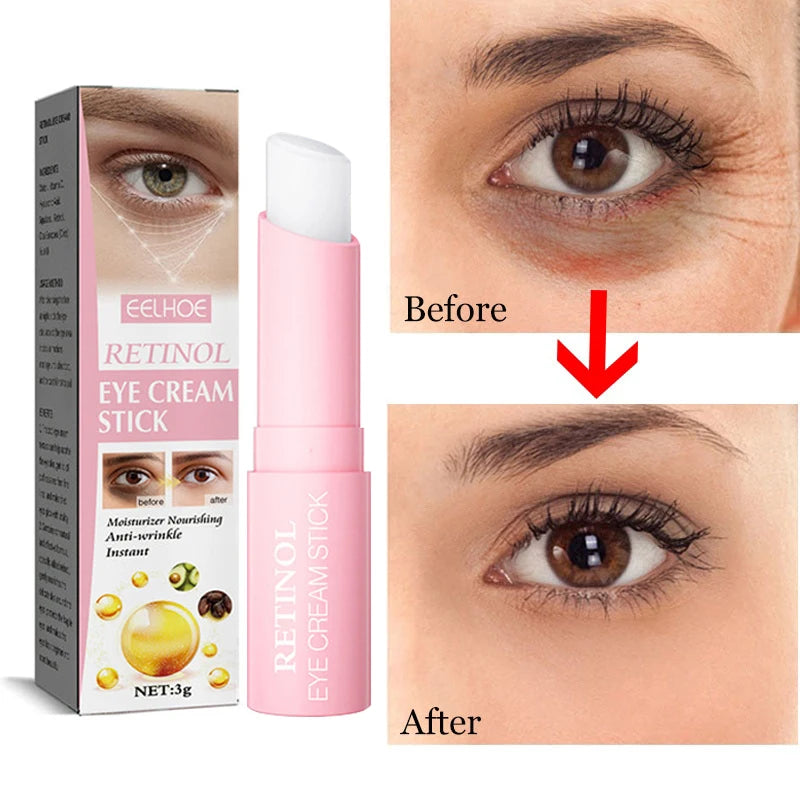 Cream that eliminates anti-wrinkle expression lines