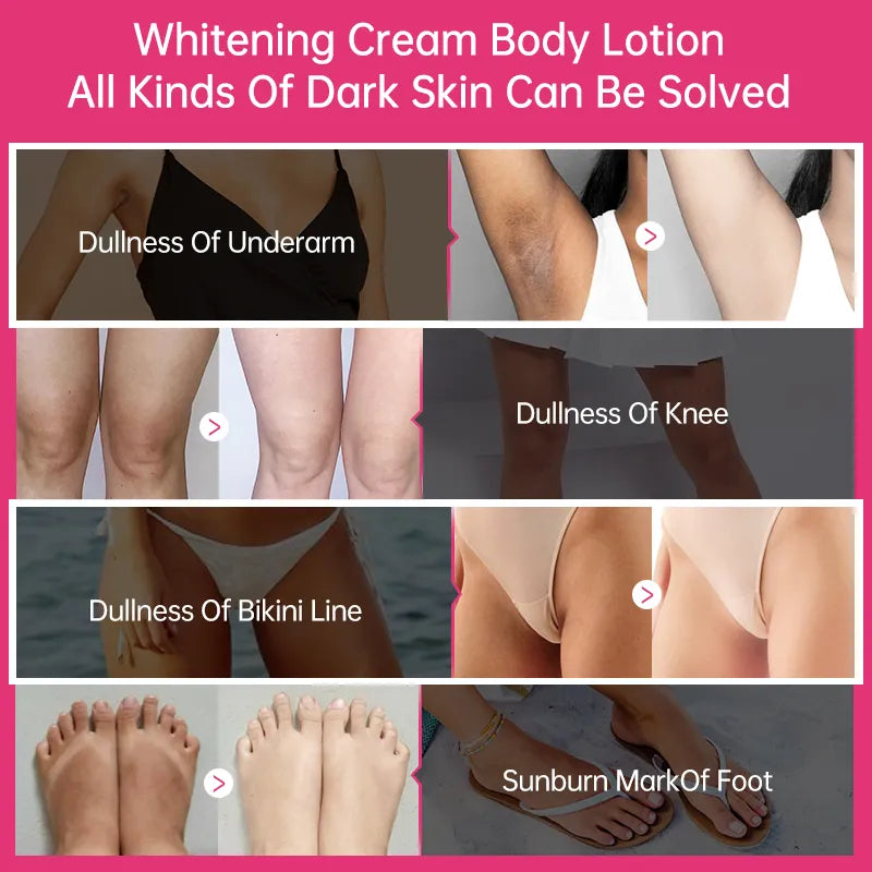 Whitening Cream for Dark Skin Armpit Lightening Intimate Areas Underarm Body Skin